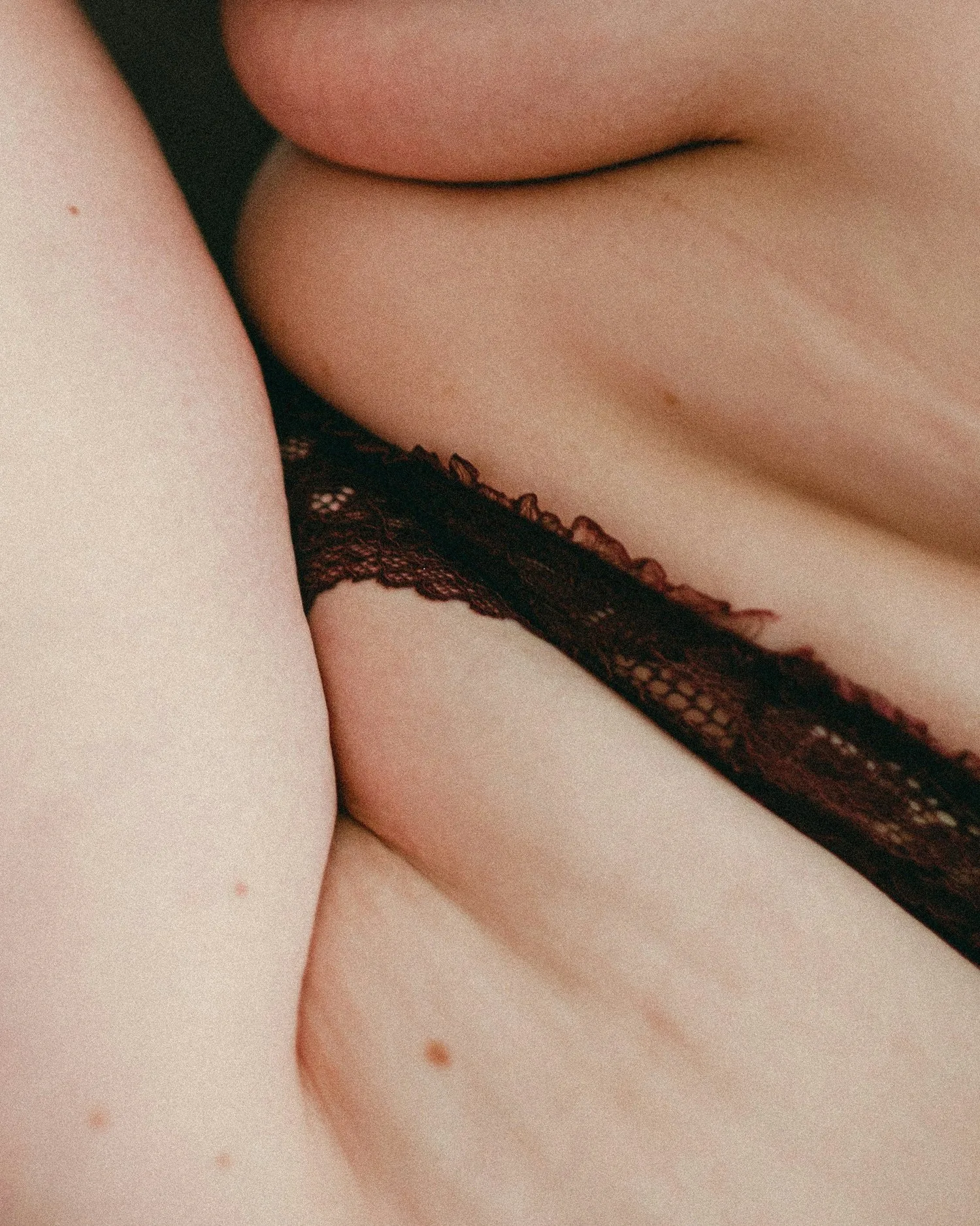 Close-up of skin along a lace bra strap